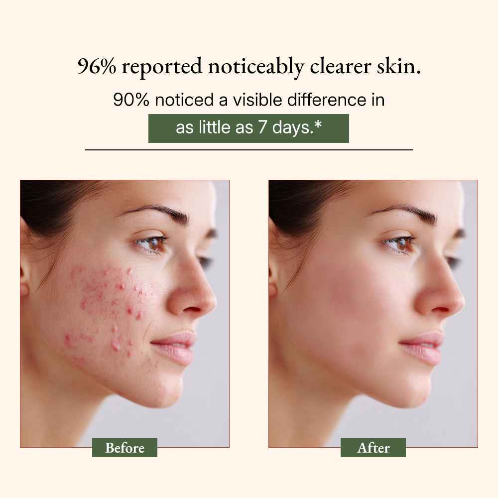 Ayurvedic Neem Soap Bar