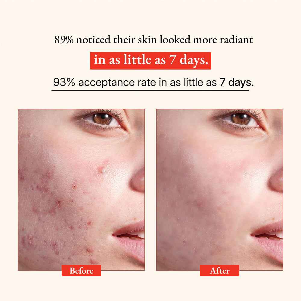 Glow Vitamin C Skin Brightening Serum